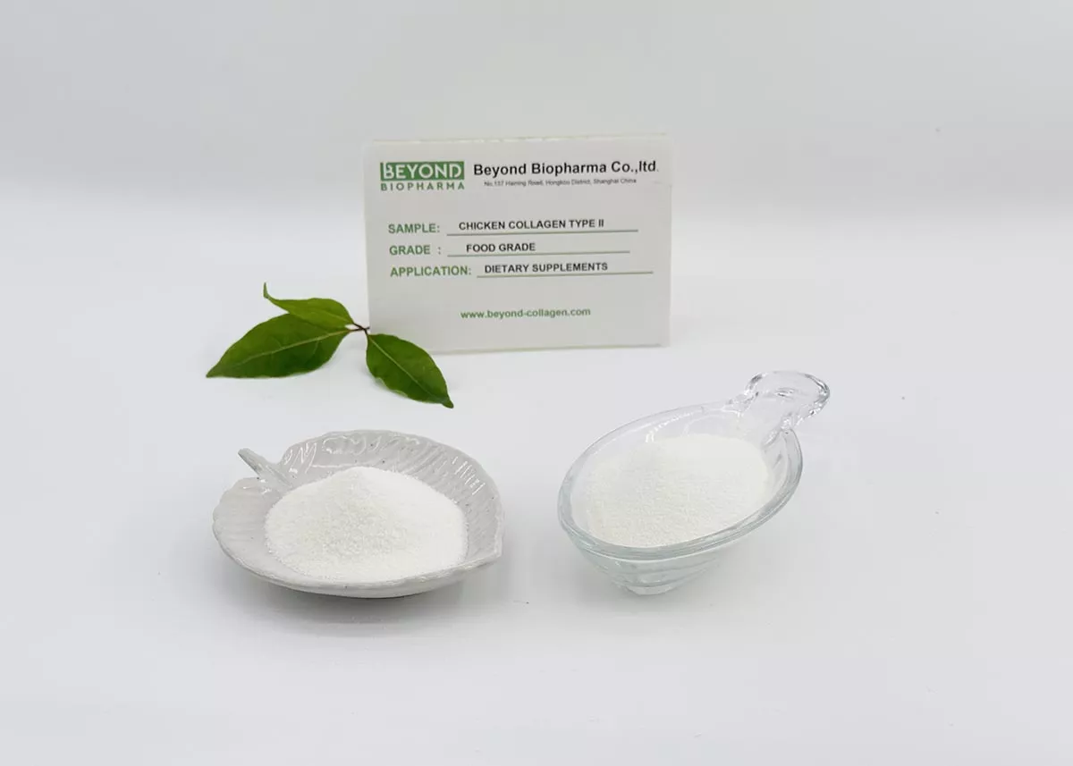 Undenatured Collagen Type II for Joint